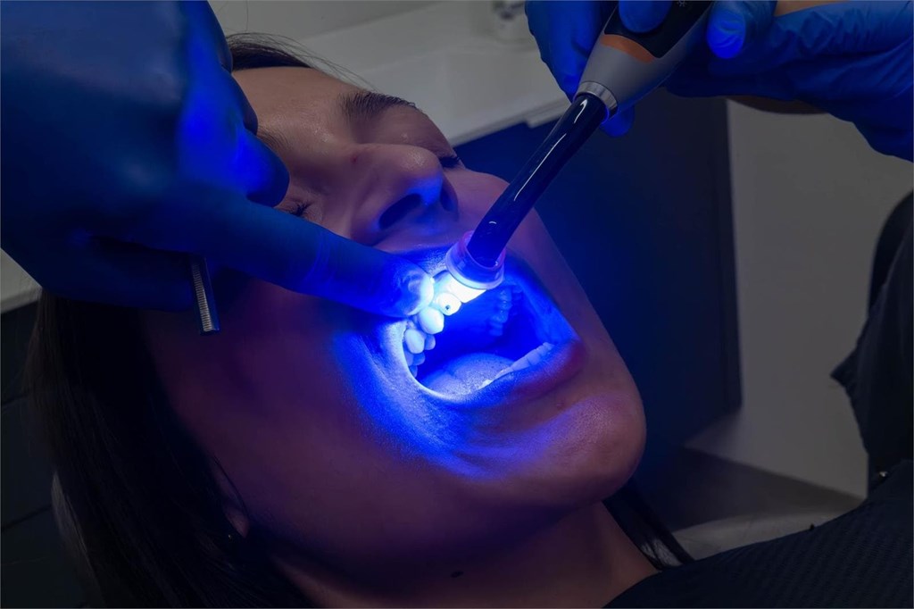 5 consejos si estás pensando en realizarte un blanqueamiento dental
