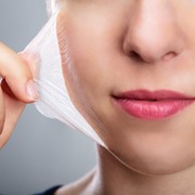 ¿A partir de qué edad se puede hacer un peeling químico?