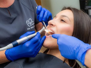 ¿Cada cuánto tiempo deben hacerse las limpiezas dentales?