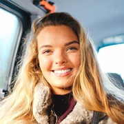 ¿Cada cuánto tiempo me puedo hacer un blanqueamiento dental?