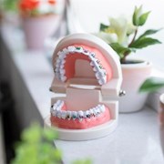 ¿Cómo se tienen que limpiar los brackets?