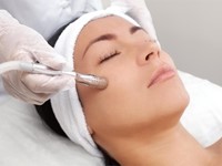 ¿Cuáles son los beneficios del tratamiento microneedling con Dermapen?