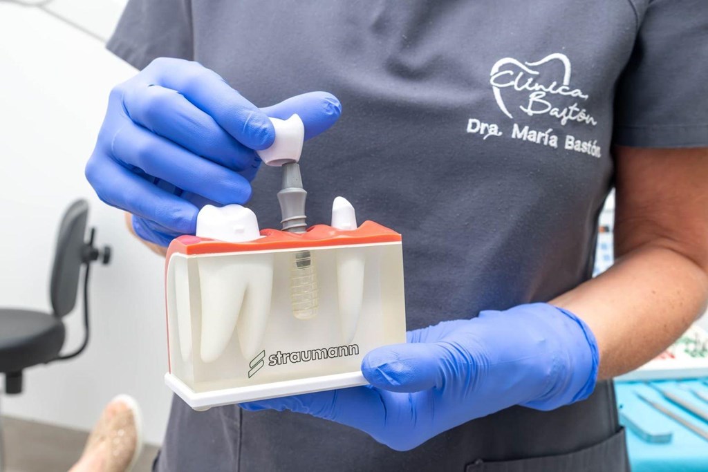 ¿Duele ponerse un implante dental? Nuestros dentistas en Vigo te lo cuentan sin rodeos