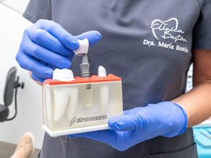 ¿Duele ponerse un implante dental? Nuestros dentistas en Vigo te lo cuentan sin rodeos