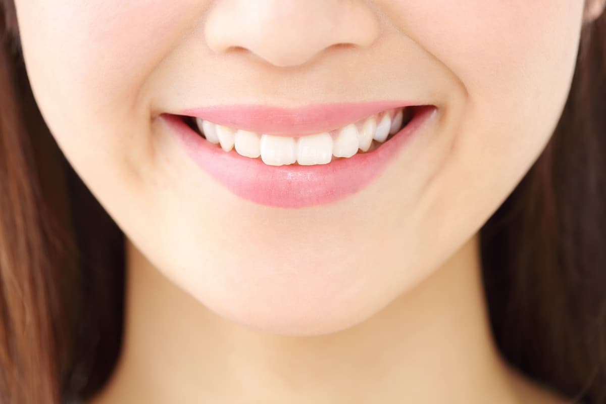 Tratamientos de estética dental en Vigo