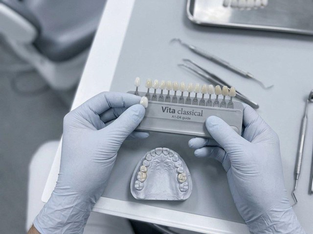 Luce una sonrisa perfecta con carillas de porcelana en Vigo - Imagen 1
