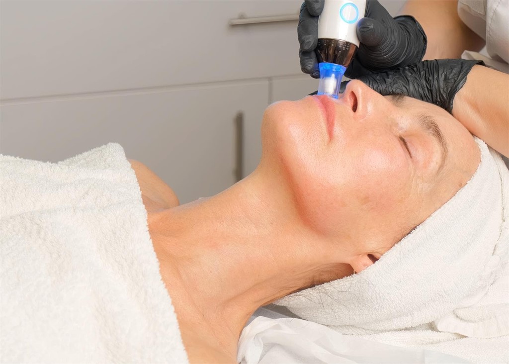 Microneedling con Dermapen: Cómo lograr una piel más lisa y rejuvenecida