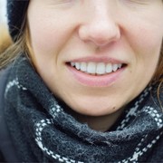 ¿Qué son los implantes dentales? Ventajas de este tratamiento dental